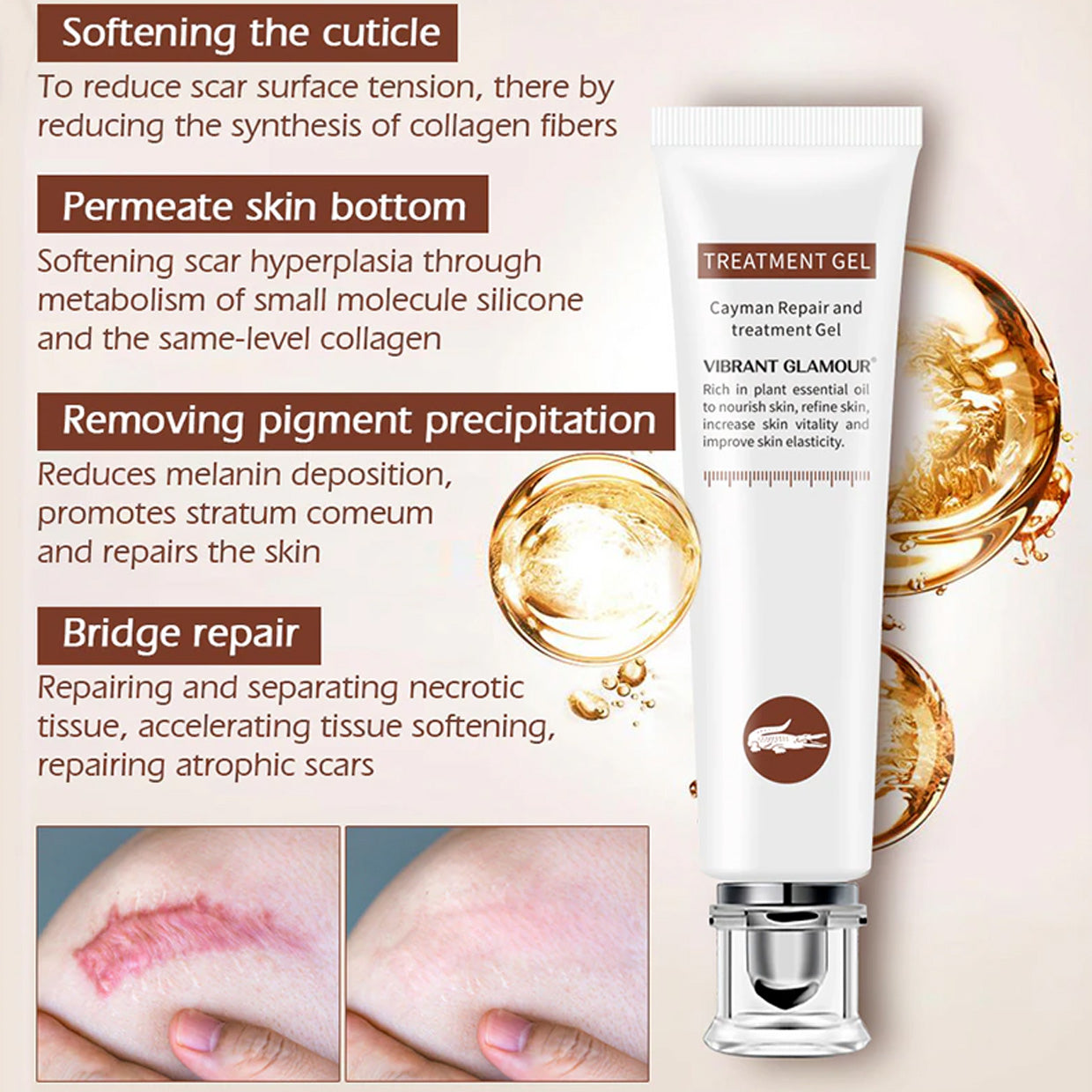 VIBRANT GLAMOUR FDA Scar Remover Gel Repair