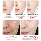 VIBRANT GLAMOUR FDA Double Retinol α-Arbutin Whitening Face Toner Set Anti-aging Niacinamide Reduce Dark Spots Freckles (1 retinol toner + 1 arbutin toner) Facial Skincare