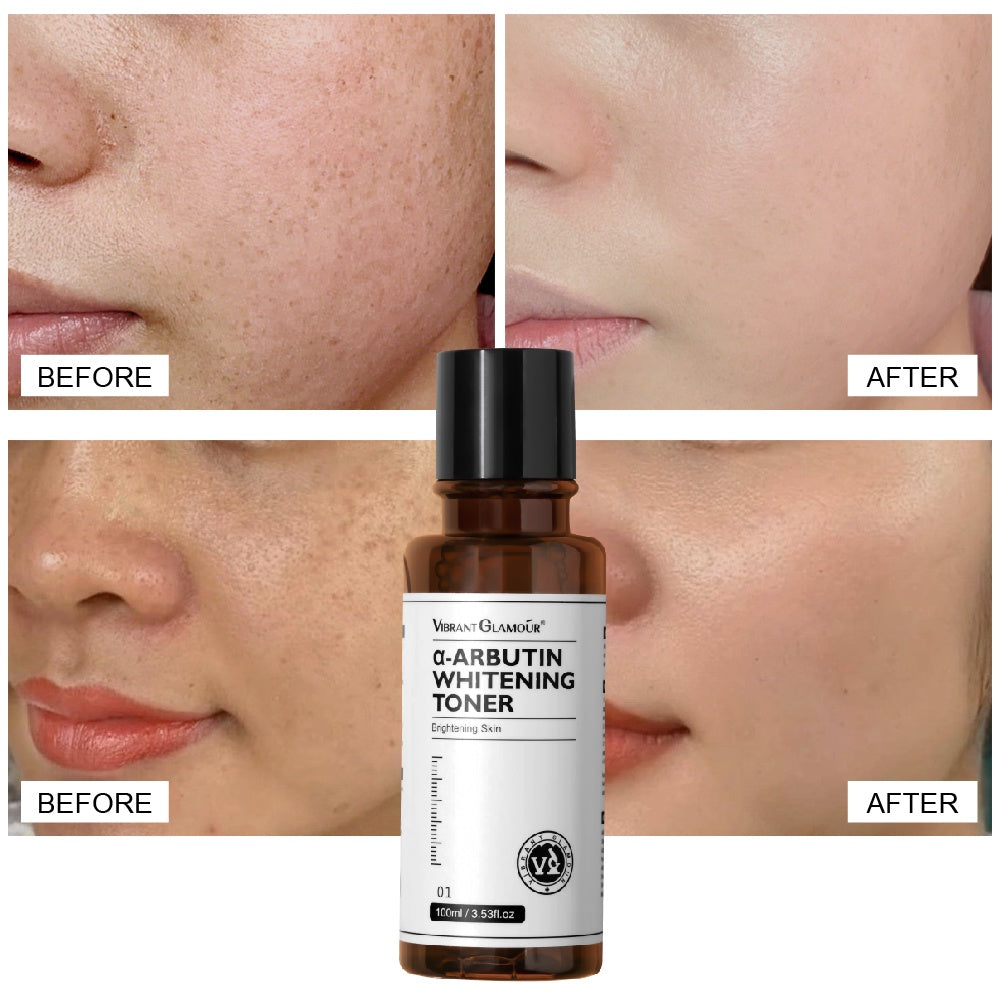 VG Vibrant Glamour - α-Arbutin Whitening Toner Niacinamide Reduce Dark Spots Freckles Pigmentation Facial Moisturizer 100ml Hydrating Skincare