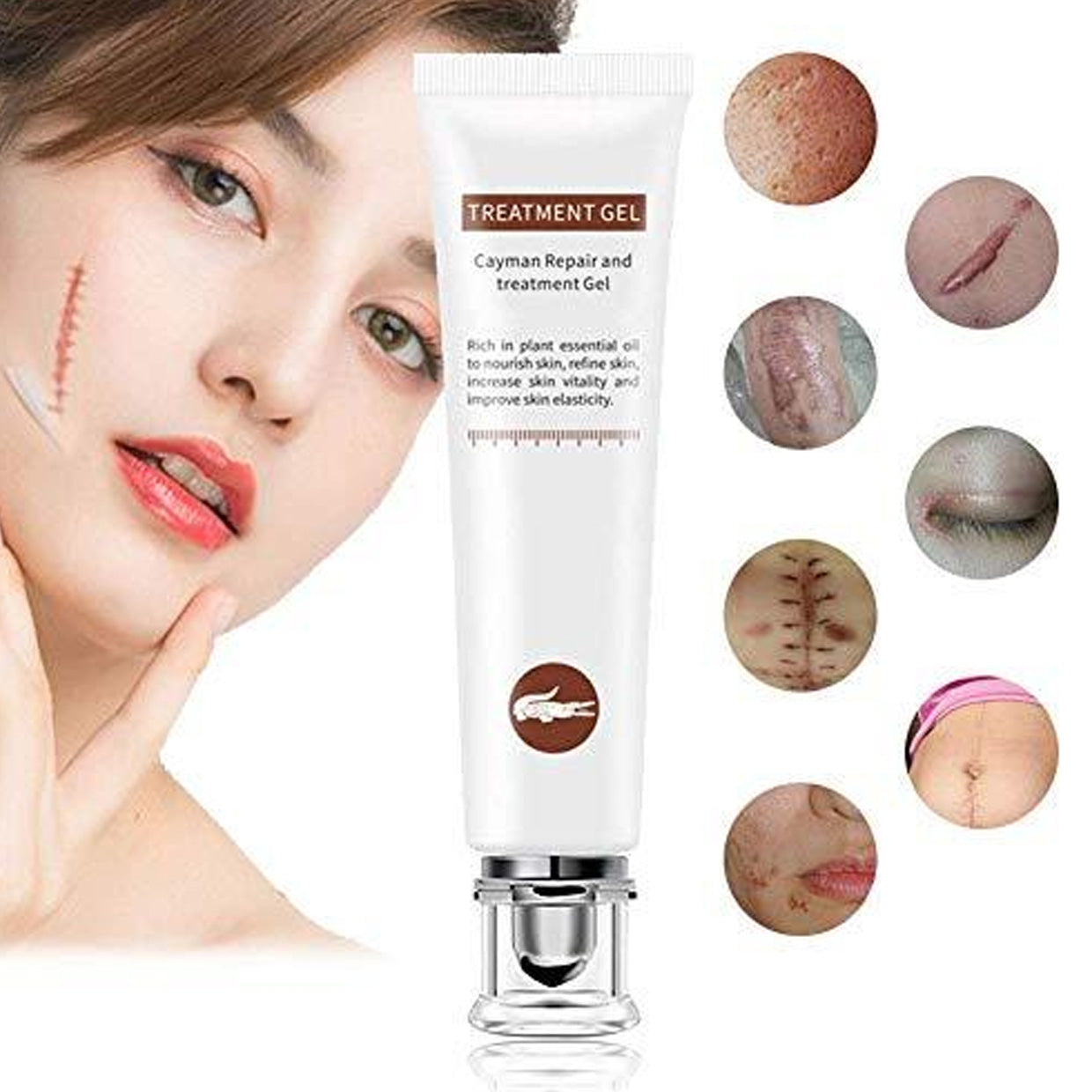 VIBRANT GLAMOUR FDA Scar Remover Gel Repair